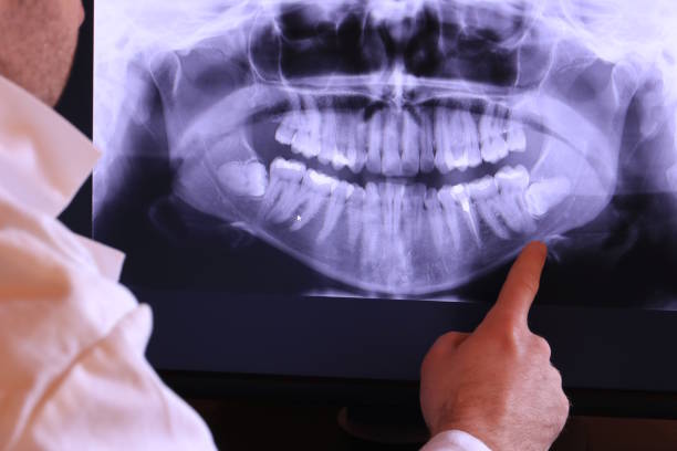 Best Emergency Root Canal Treatment in Hansville, WA