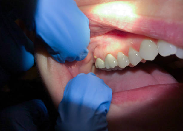 Best Walk-In Emergency Dentist in Hansville, WA